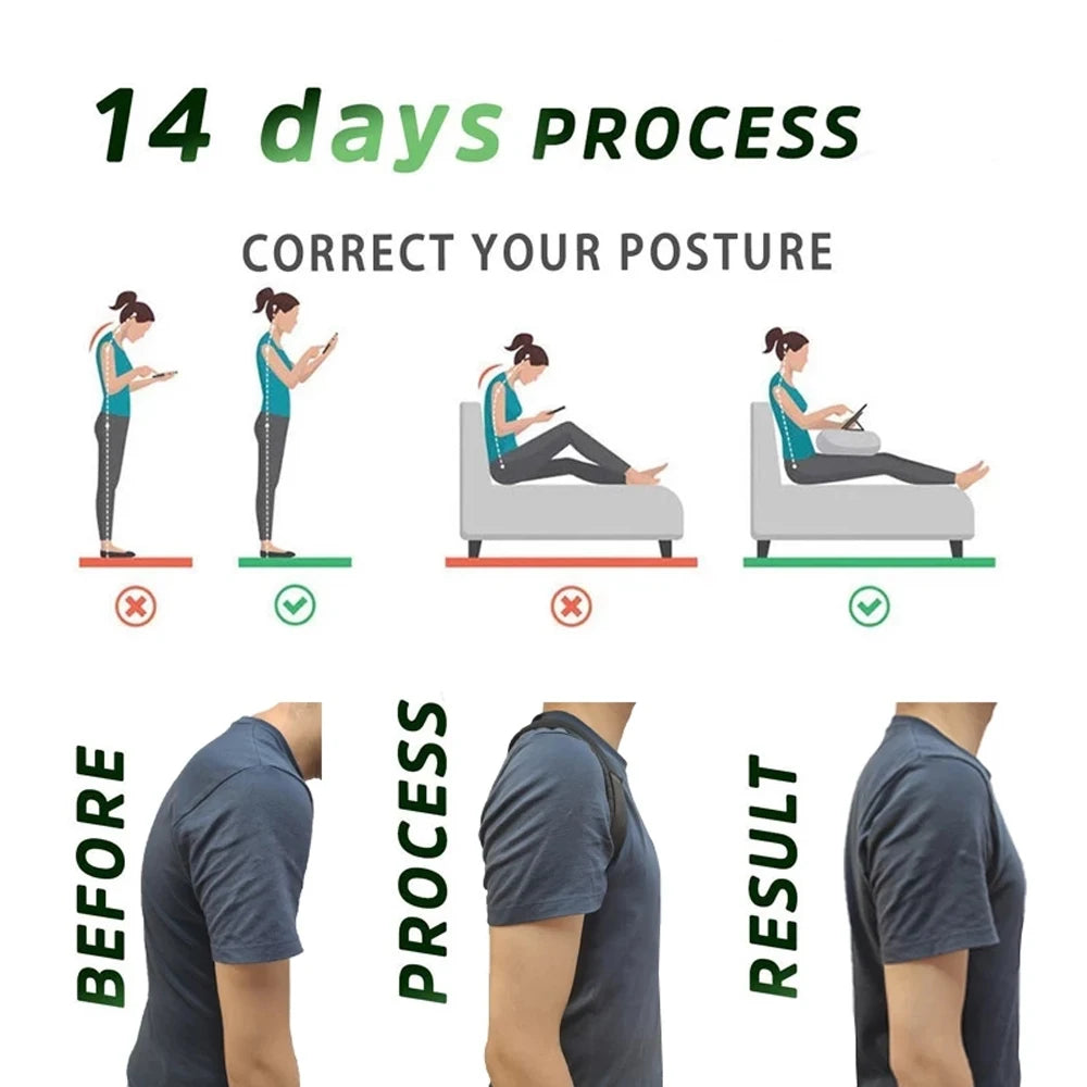 Align Posture Corrector – Adjustable Back & Shoulder Support Brace